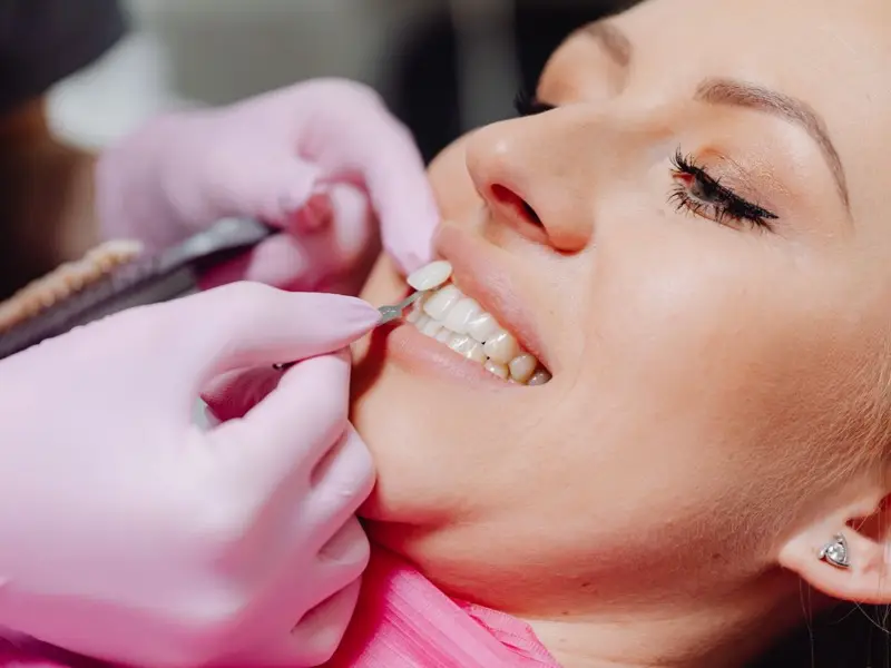 A dentist matching a veneer shade against a patient's teeth